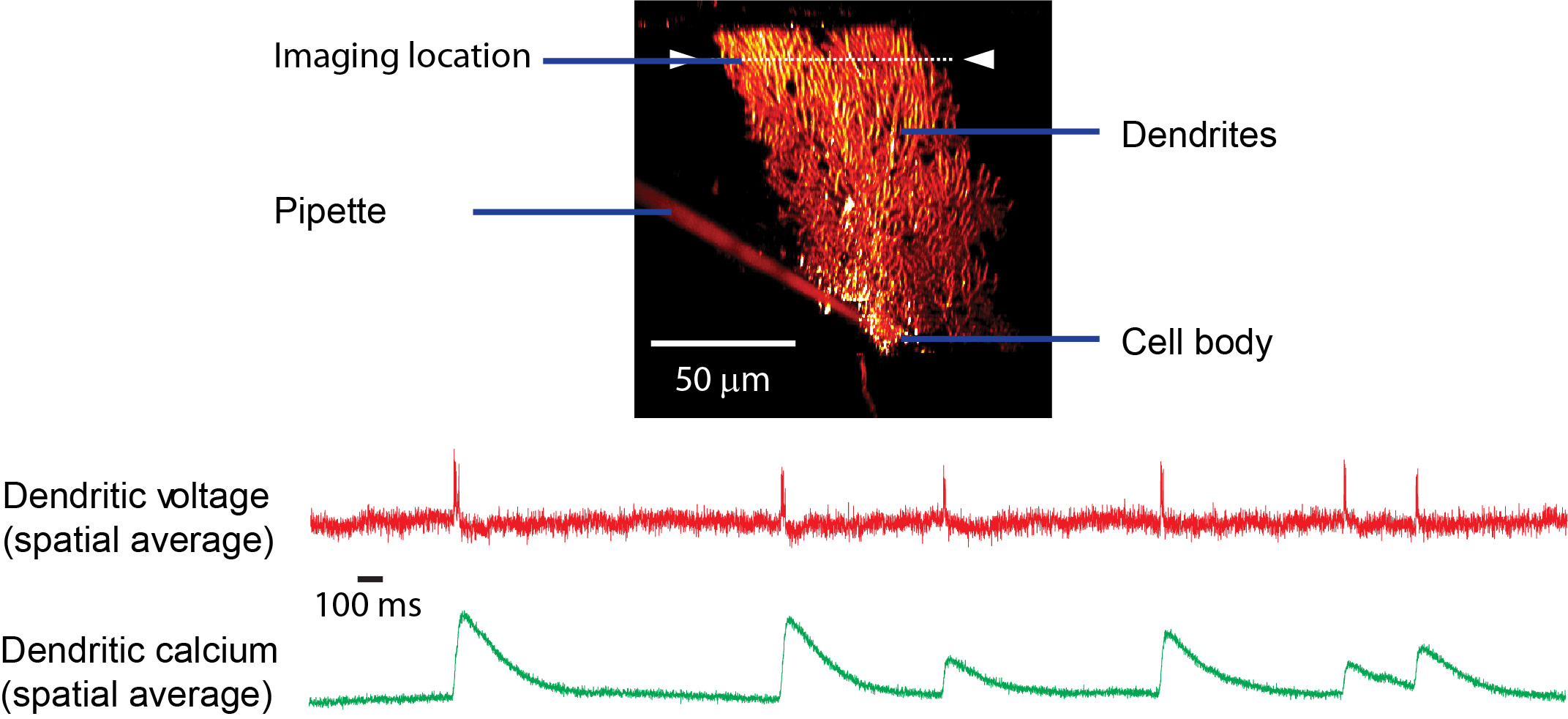 A Purkinje neuron labeled with a voltagesensitive dye shows
